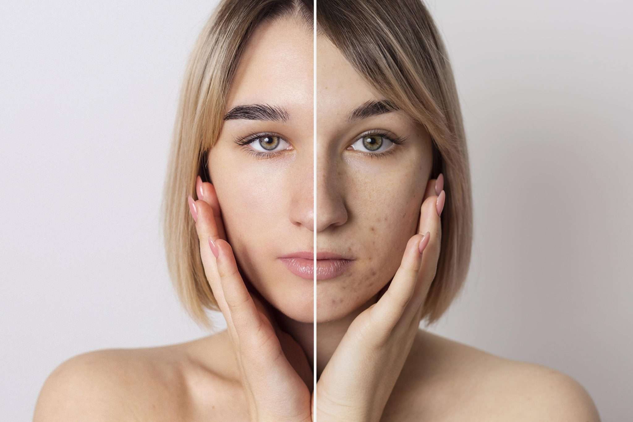 before-after-portrait-woman-retouched-1-2048×1365