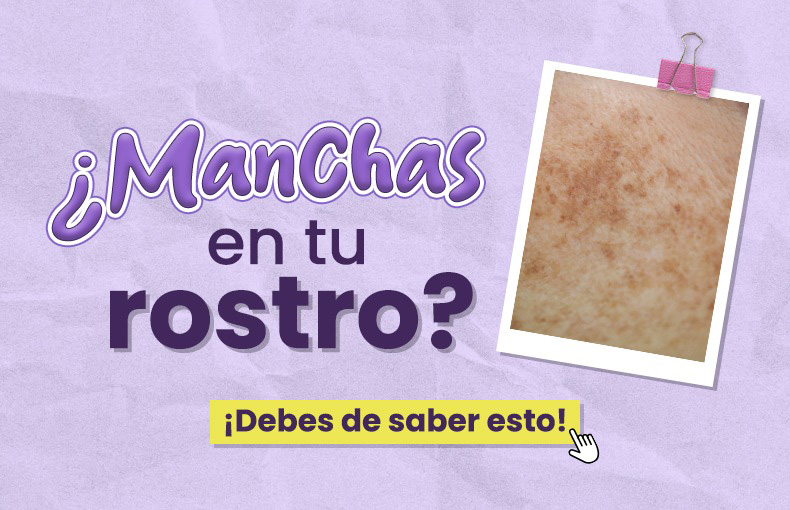 prevenir manchas por el sol - por qué salen manchas en la piel - melasma-hiperpigmentación-rutina de skincare-ácido hialurónico-manchas de la edad-la-roche-posay-vitamina C para manchas-manchas rojas en la piel-tipos de manchas en la piel fotos-manchas blancas en la piel